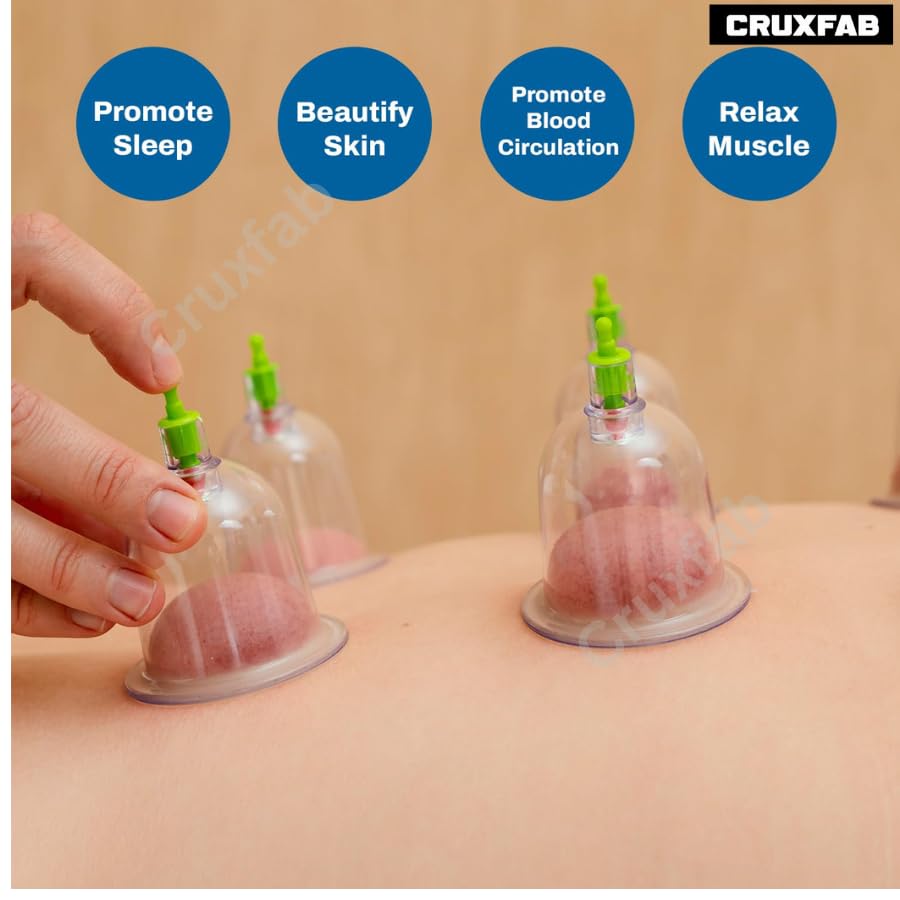 32 Pcs Hijama Loose Cupping Kit