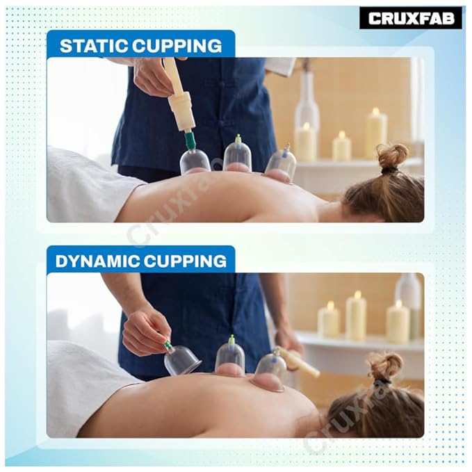 24 Pcs Hijama Loose Cupping Kit