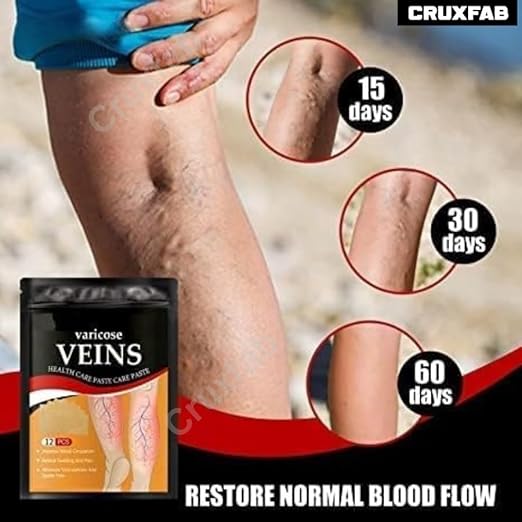 Varicose Veins Patches